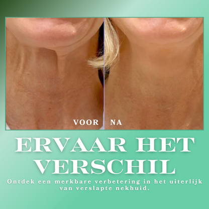 Vitalifté™ | De Anti-Aging Oplossing